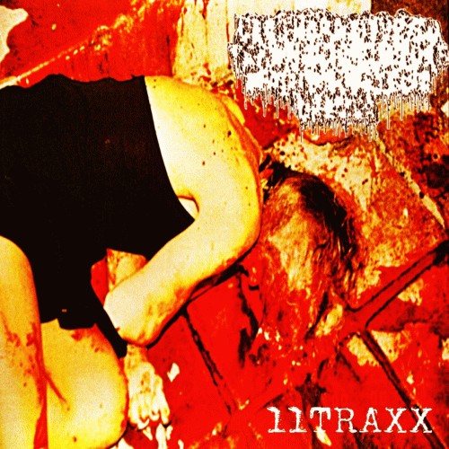 Acanthosis Nigrcans : 11Traxx Acanthosis Nigrcans : 11Traxx